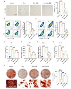 Fig. 3. Liposomal dasatinib and quercetin synergistically eliminate senescent BMMSCs.