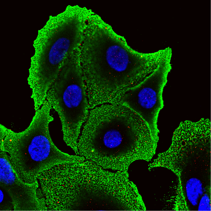 Chemoresistant SW480 colon cancer cells