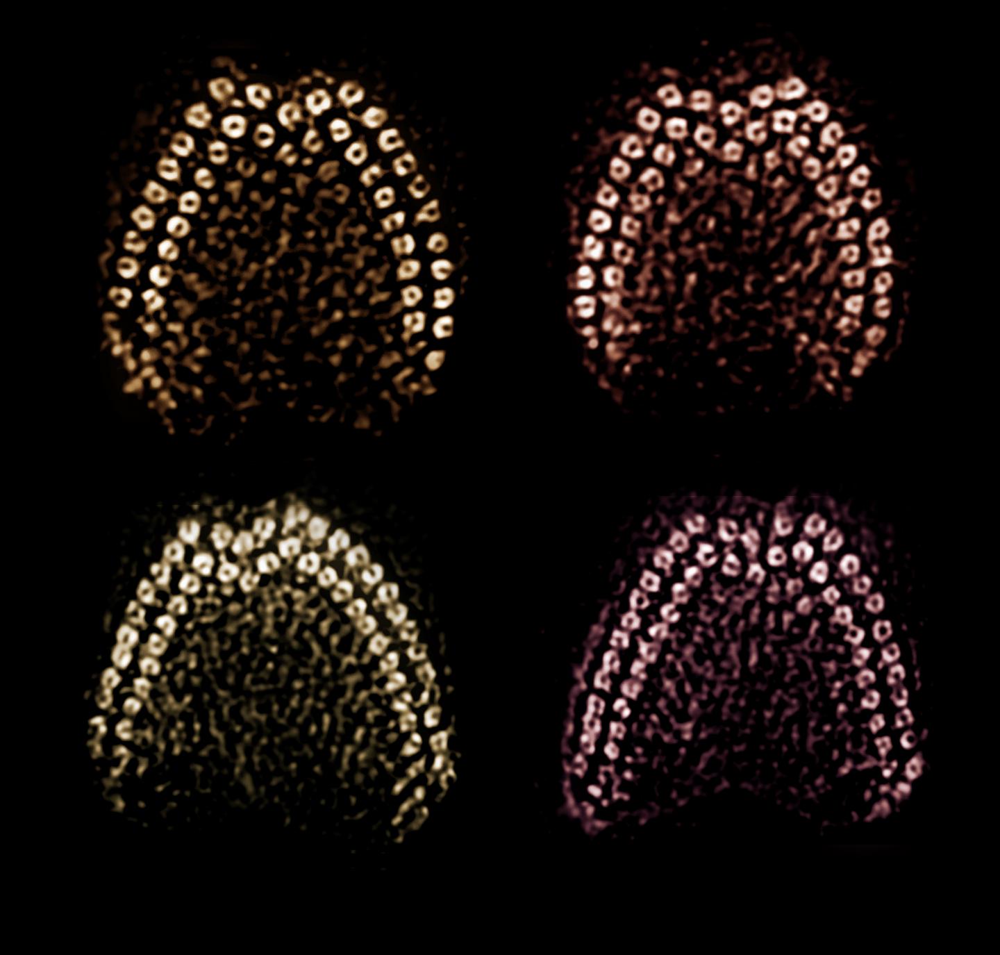 Spectrin Proteins Are a Crucial Anchor in Hearing (2 of 2)