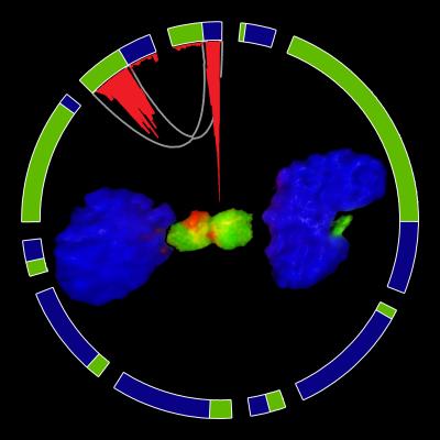 Telltale Fusion Gene in Brain Cancer (3 of 4)