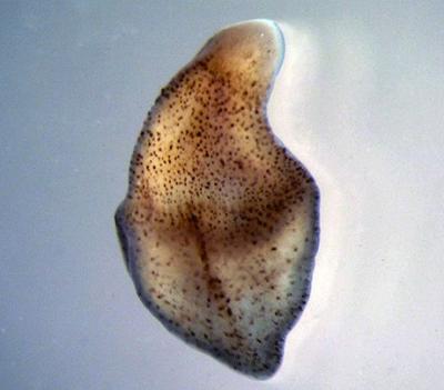 The <i>Xenoturbella bocki </i>Worm