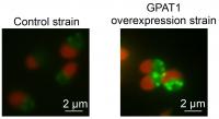 Algal oil accumulation through <em>GPAT1</em> overexpression