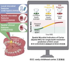 Spatial-MiC