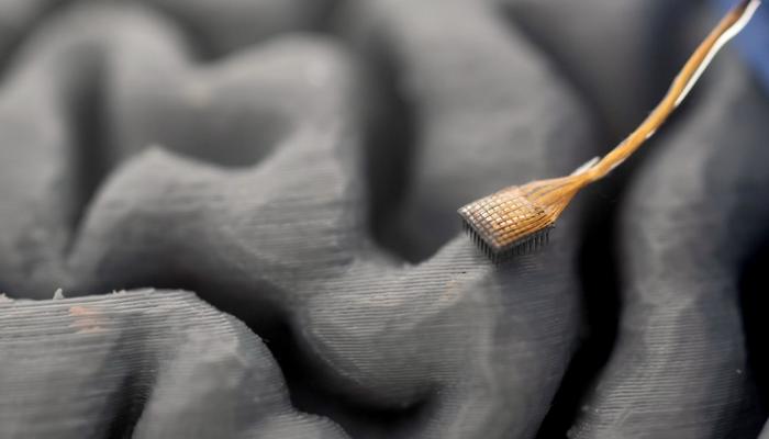 3D Model of Implant