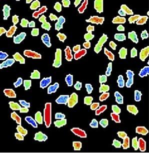 <i>Klebsiella oxytoca</i>
