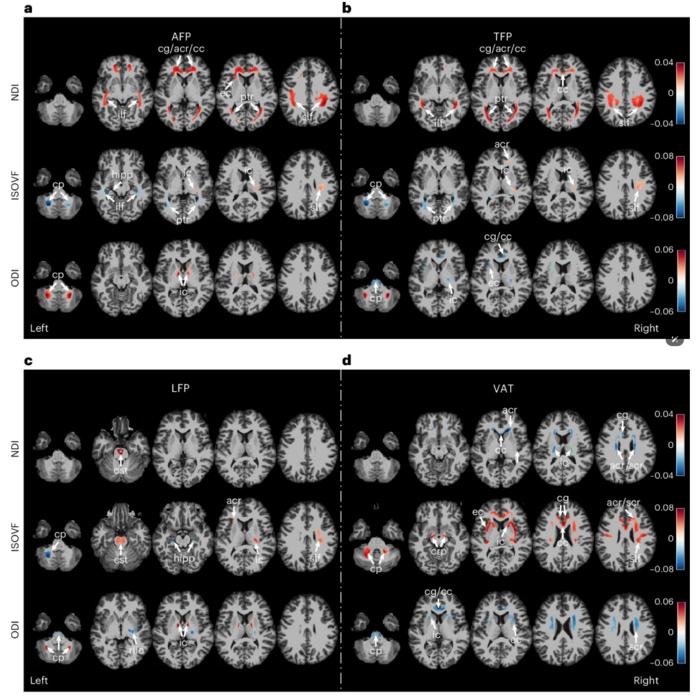 PolyU research reveals fat distribution as key to brain health, with visceral fat accumulation significantly accelerating brain ageing and showing much stronger association than BMI