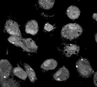 How Cells Respond when Invaded by Bacteria