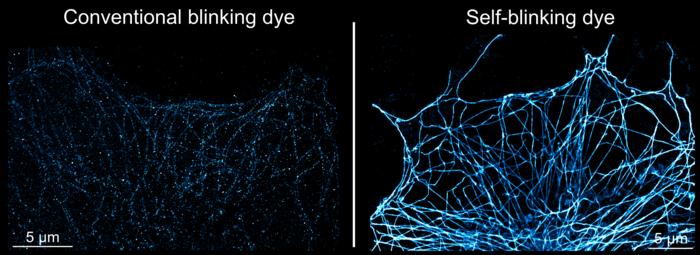 super-resolution imaging comparing conventional blinking dye with self-blinking dye