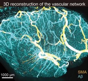 3D reconstruction of the vascular network.