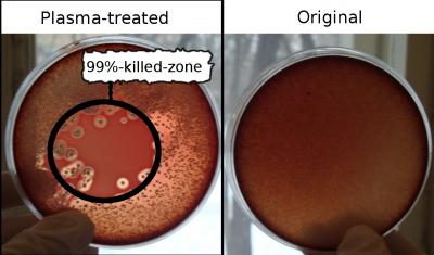 Bacterium Killing with Plasma