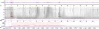 Red-Tailed Hawk Sonogram