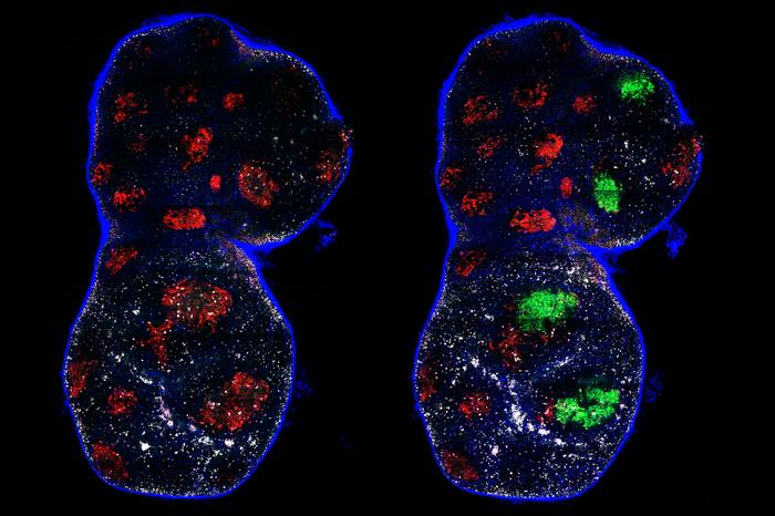 Germinal centers