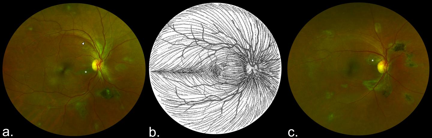 Composite Scanning Laser Ophthalmoscope Retinal Images