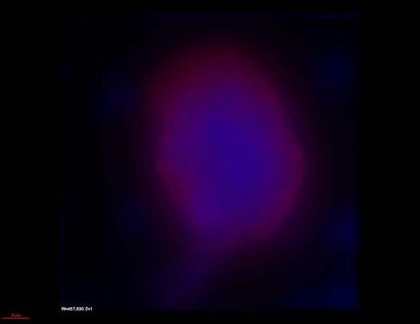 Cell to Cell Transmission