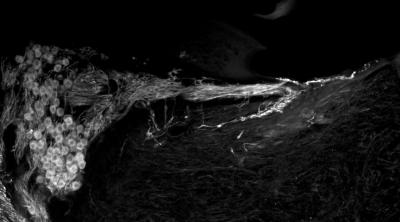 Cochlear Implant Gets an Upgrade with Gene Therapy (3 of 10)