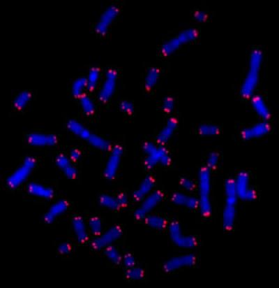 An Electron Micrograph Showing Telomeres in Red