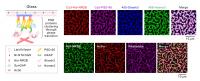 PSD Condensates on Membrane