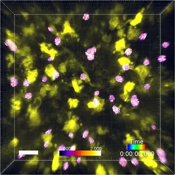 Dendritic Cells Testing T-Cells for Autoreactivity