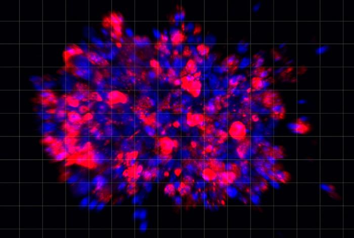 Scientists Use Organoid Model to Identify Potential New Pancreatic Cancer Treatment