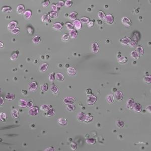 Cell death in microscope