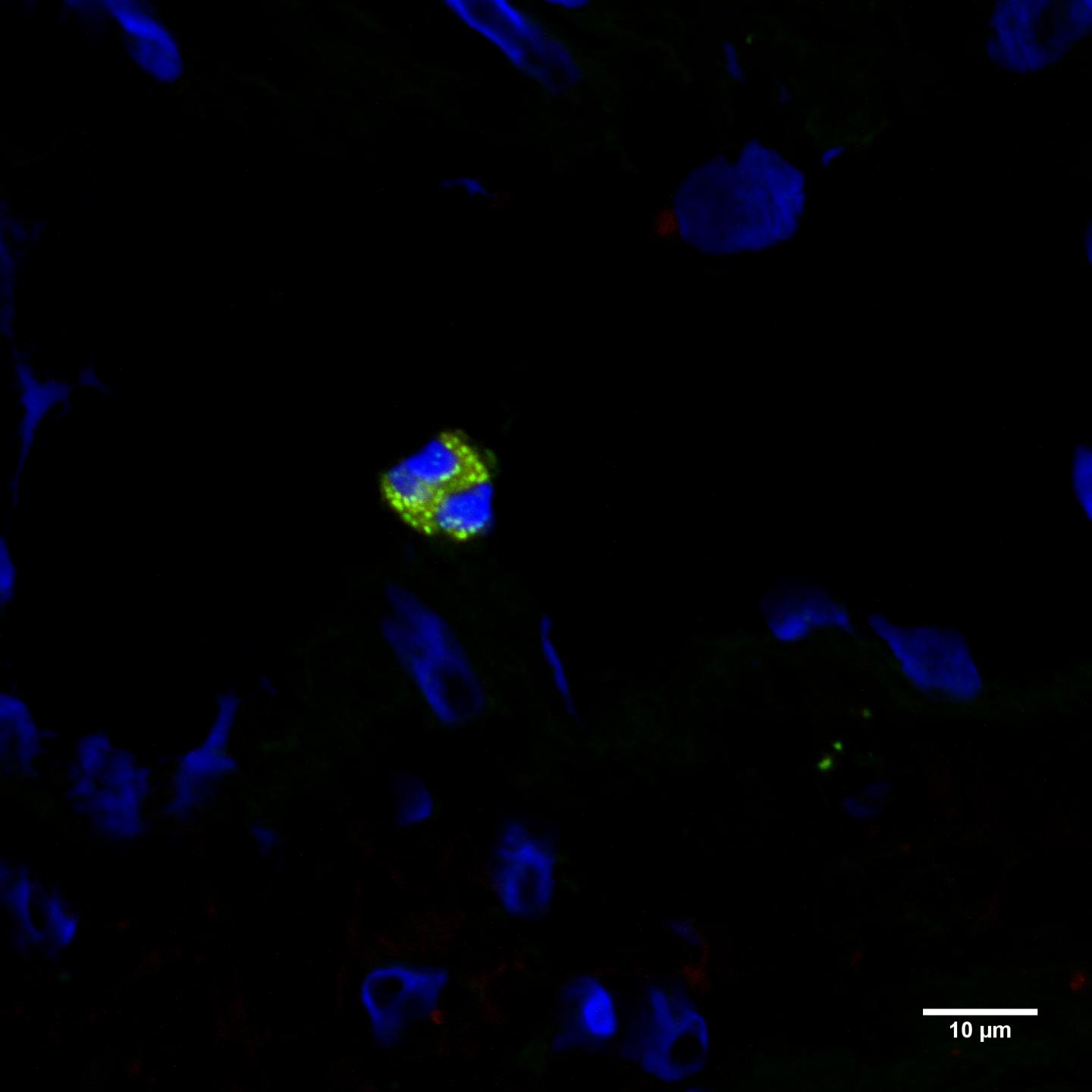 P2X4 Receptors (green) Inside the Eosinophil