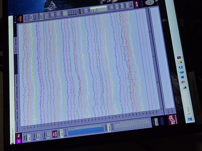 Brain waves