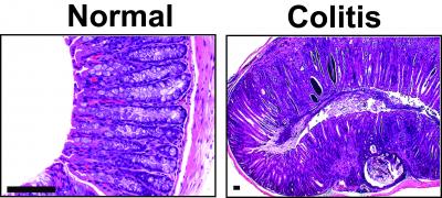 Images of Normal and Diseased Colon