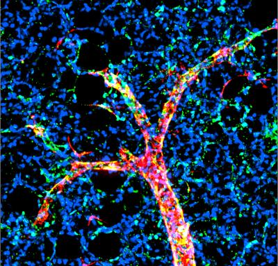 Smooth Muscle Cells