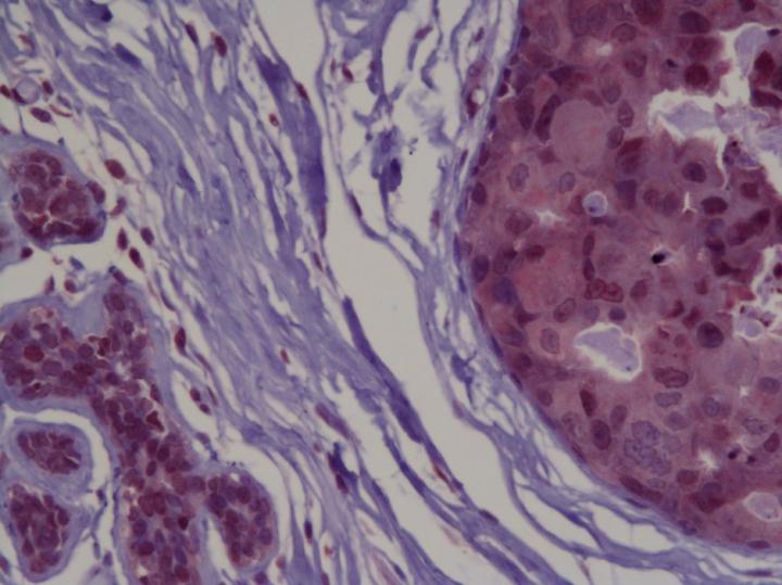 Breast Tissue Staining