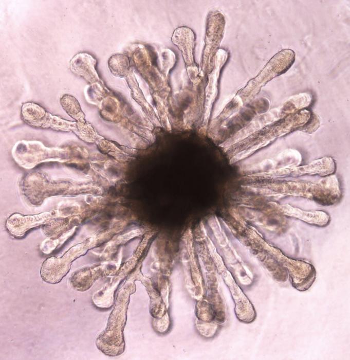 Kidney organoid