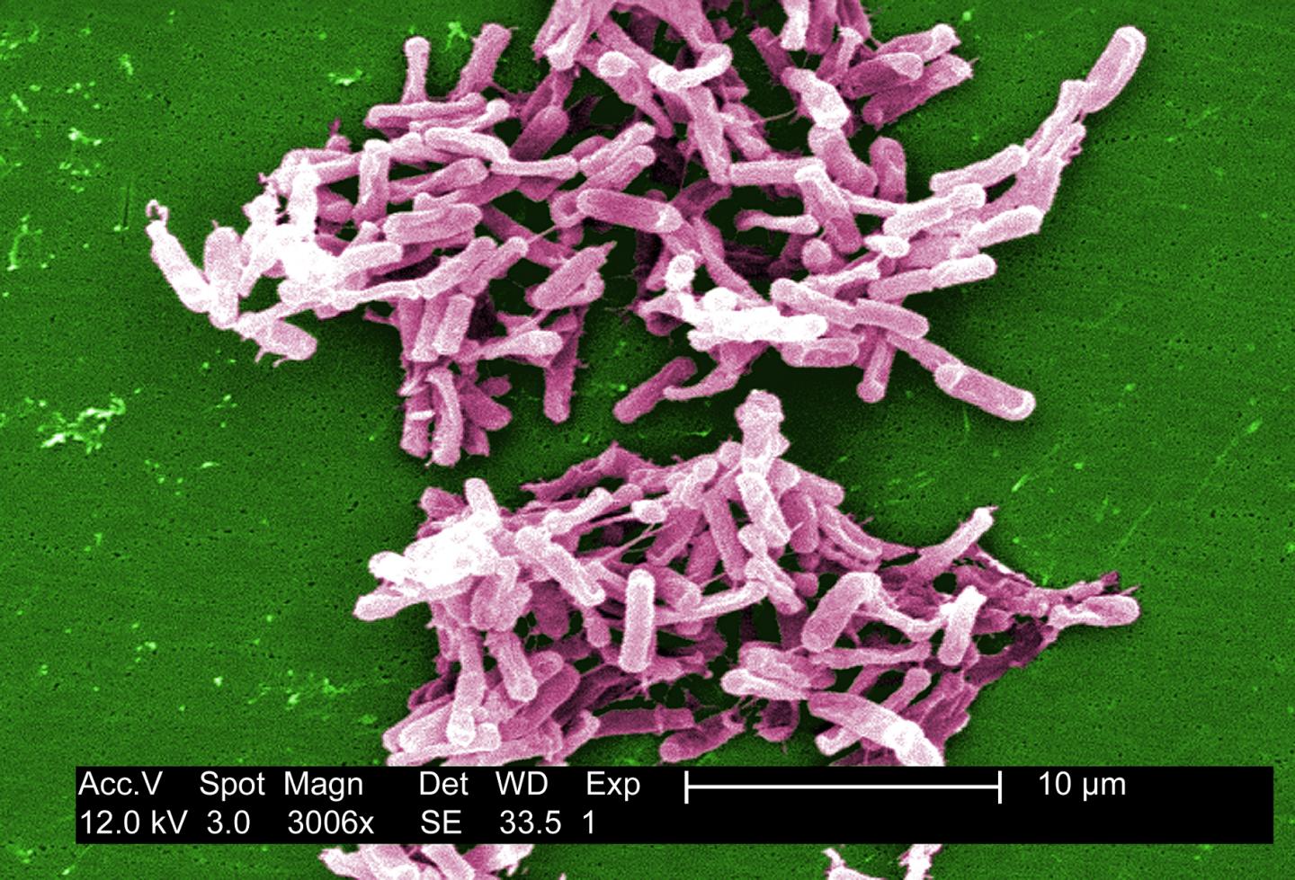 <i>Clostridium difficile</i>