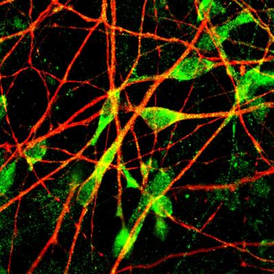 Human Serotonergic Neurons