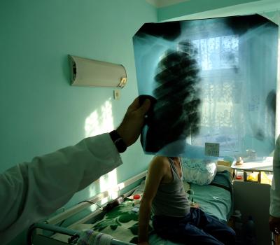 New Consensus Reached to Help Tackle Multidrug-Resistant and Extensively Drug-Resistant TB
