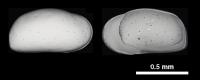 Calcitic Shells Of Deep-Sea Ostracod Genus Krithe
