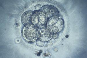 Human embryo for IVF