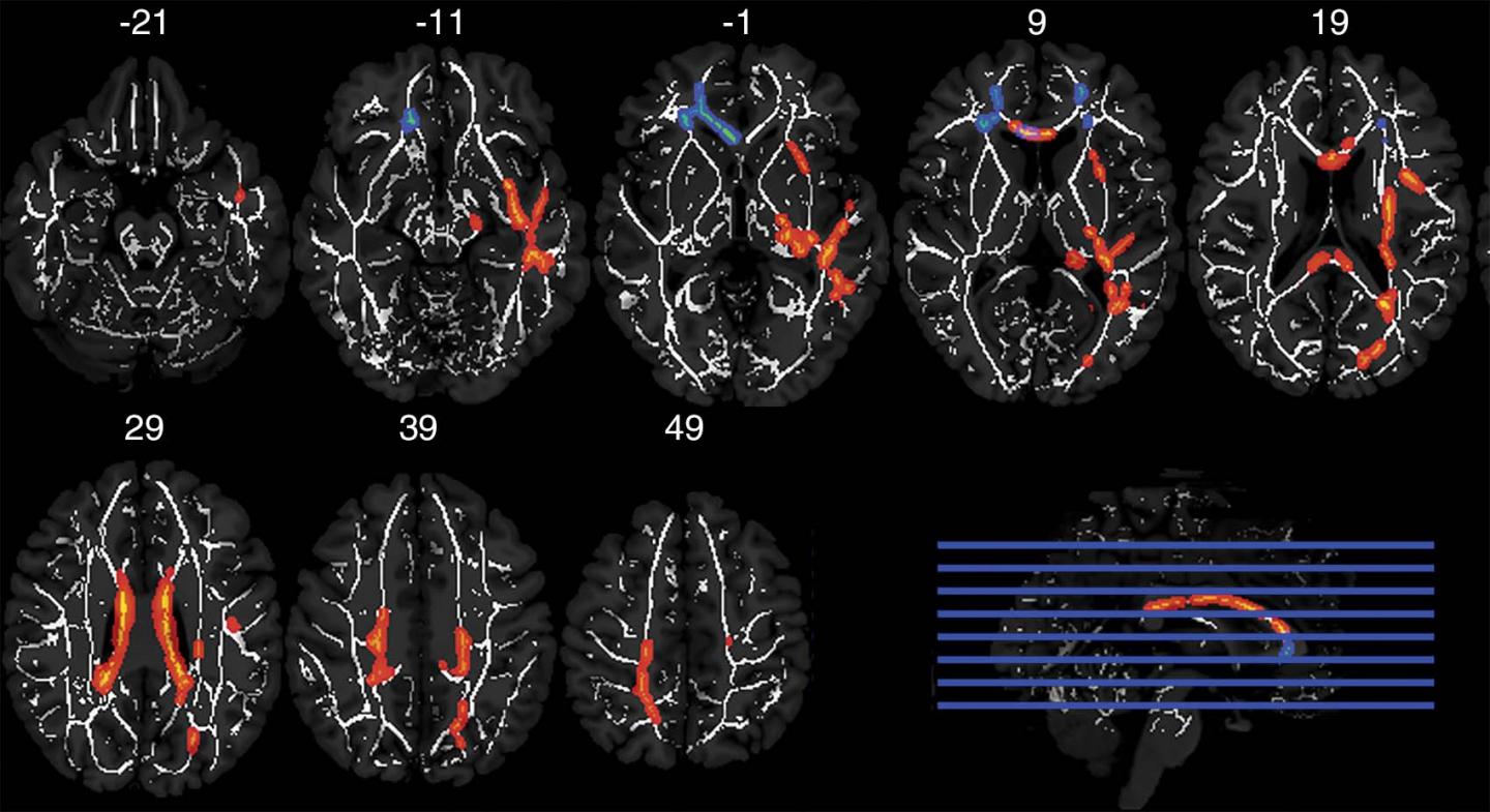 Image 1 Axial MRIs