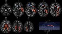 Image 1 Axial MRIs