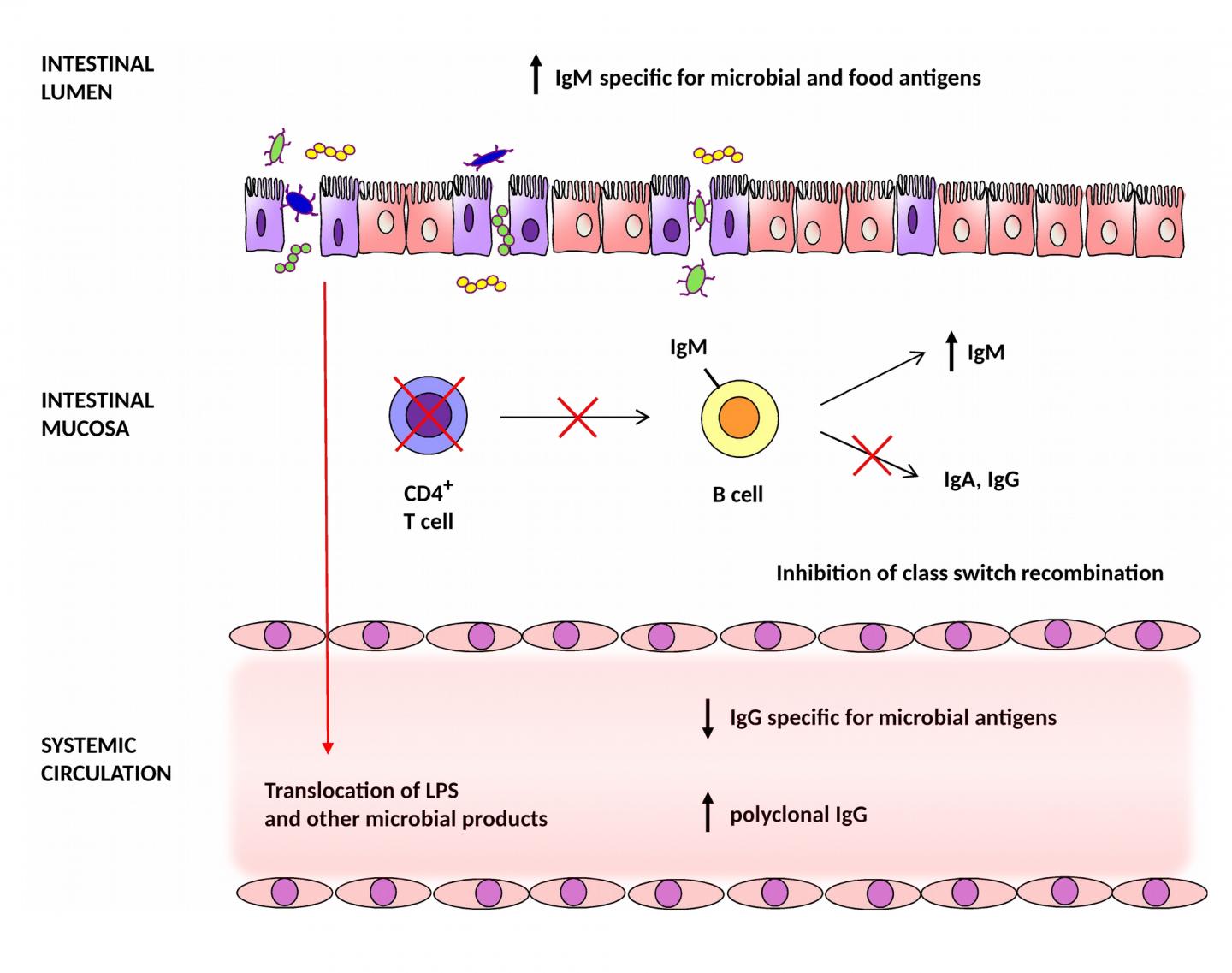 Abnormal Antibody Levels in Intestine May Promote Inflammation in People with HIV-1