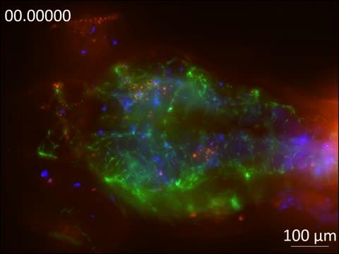 Zebrafish Larva Infected with Cryptococcal Meningitis (2 of 2)