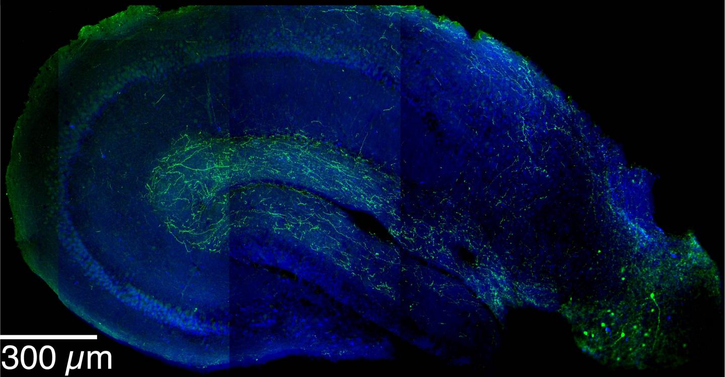 LRIPs Extend Into Hippocampus