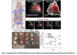 Figure 3. Implantation of Dual-Phoretic System Enhances Drug Penetration and Therapeutic Efficacy
