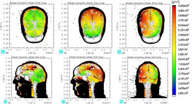 TBI Computer Simulation