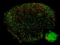 3-D Visualization of A&beta; Plaques (1 of 2)