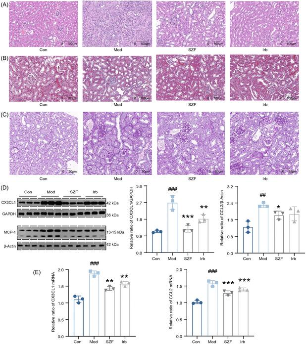 SZF ameliorates renal injury in mice by regulating CX3CL1 and MCP-1 expression.