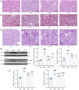 SZF ameliorates renal injury in mice by regulating CX3CL1 and MCP-1 expression.