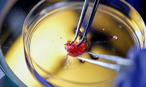 How the work began: Apple snails as a system for eye regeneration