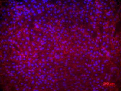 Renal Epithelium in Culture Dish