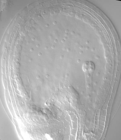 Plant Embryo