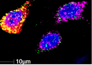 GABA cells