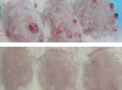 Immune Cells in Skin Can Contribute to Cancer (5 of 5)